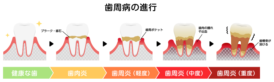 歯周組織の健康はお口の健康に直結します